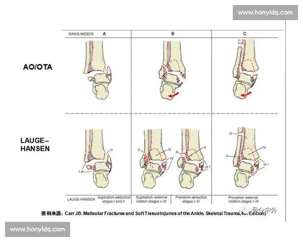 关节保护与养护方法全面解析助力提升生活质量